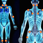 Enfermedades raras y fibromialgia
